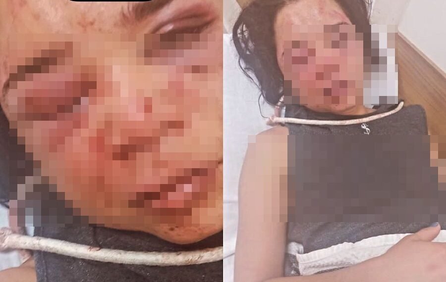 Barreiras: Delegada cumpre Mandado de Busca e Apreensão e representa pela Prisão Preventiva de empresário acusado de agredir esposa