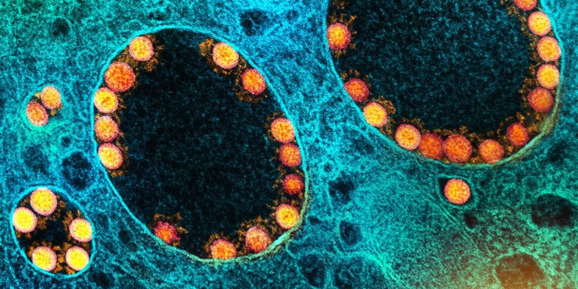São Paulo registra primeira morte pela variante BQ.1.1 da covid-19