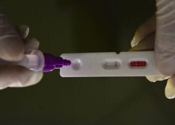 Hospitalizações por covid-19 mantêm tendência de alta nos estados