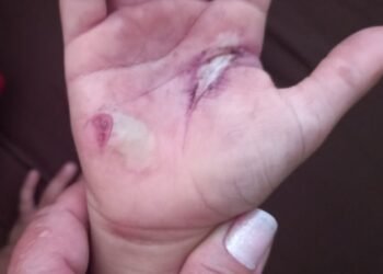 Patroa é denunciada por tortura contra criança filha da babá dos seus filhos