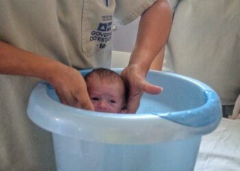 Banho de Ofurô passa a integrar os modelos de terapia ofertados aos recém-nascidos do HMIJS