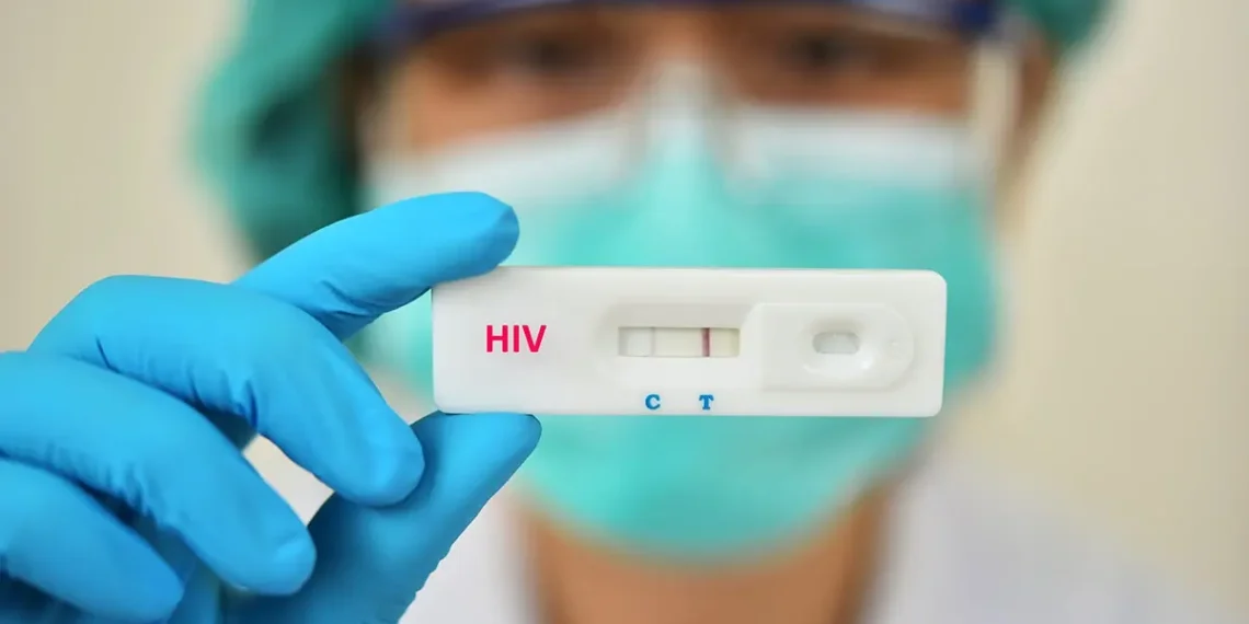 Ministério da Saúde orienta farmácias a realizar testes rápidos de HIV