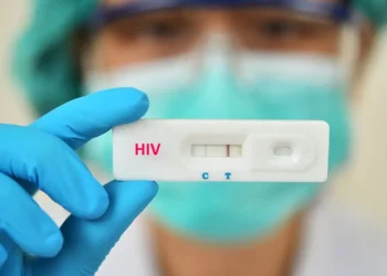 Ministério da Saúde orienta farmácias a realizar testes rápidos de HIV