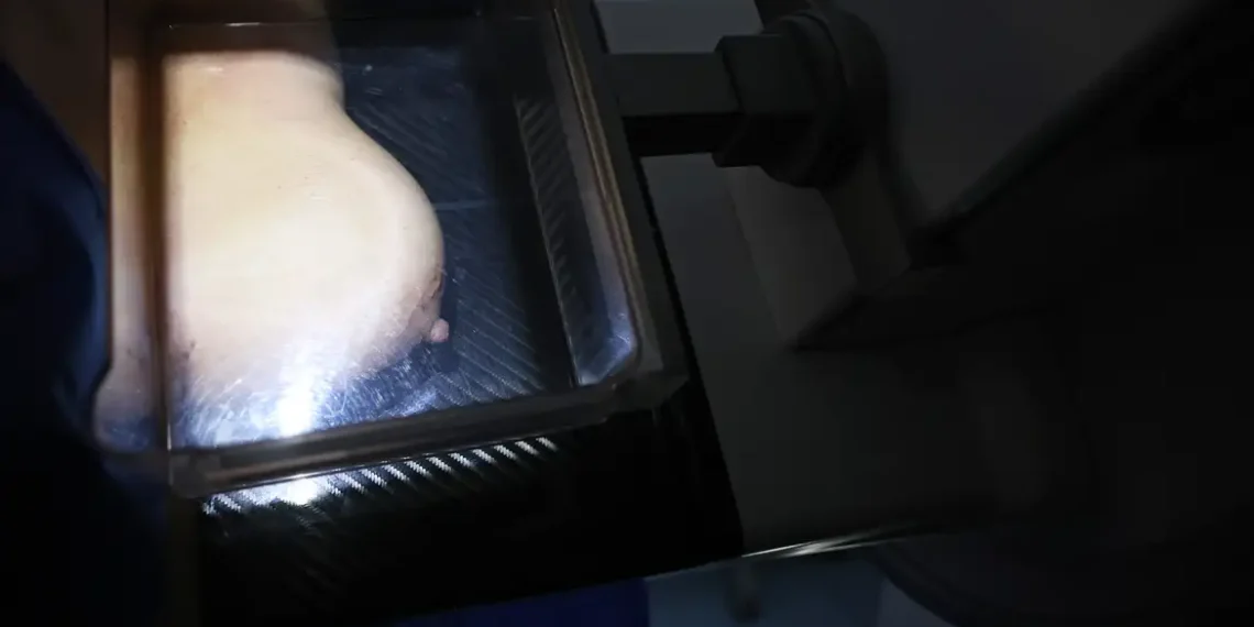 Mulheres de baixa renda terão exames gratuitos de câncer de mama