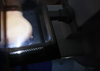 Mulheres de baixa renda terão exames gratuitos de câncer de mama