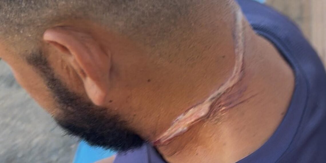 Fio de internet causa acidente grave em Barreiras; vítima sofreu lesão no pescoço