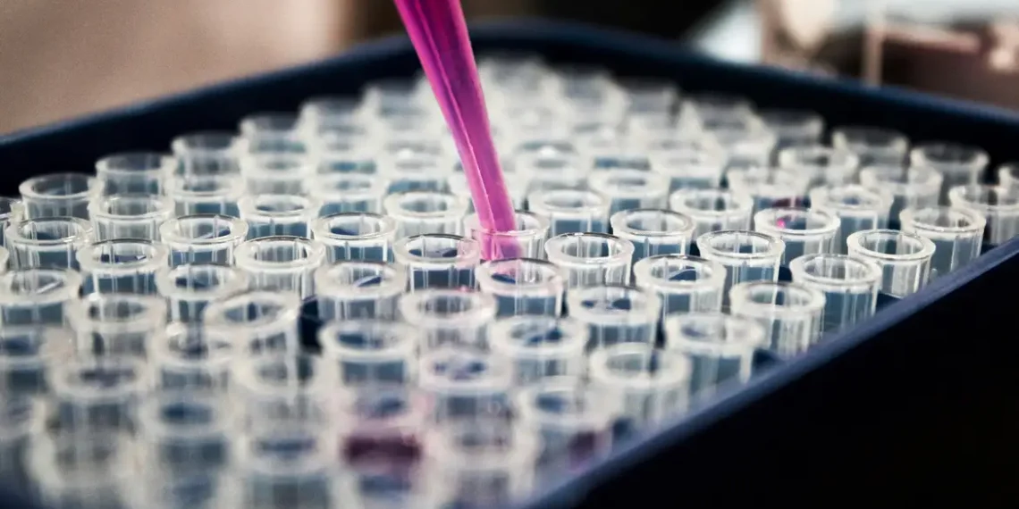 Pesquisas brasileiras avançam no diagnóstico de Alzheimer