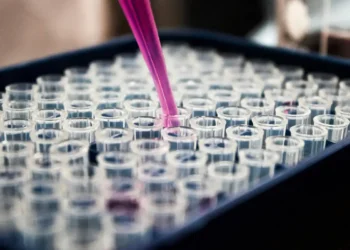 Pesquisas brasileiras avançam no diagnóstico de Alzheimer